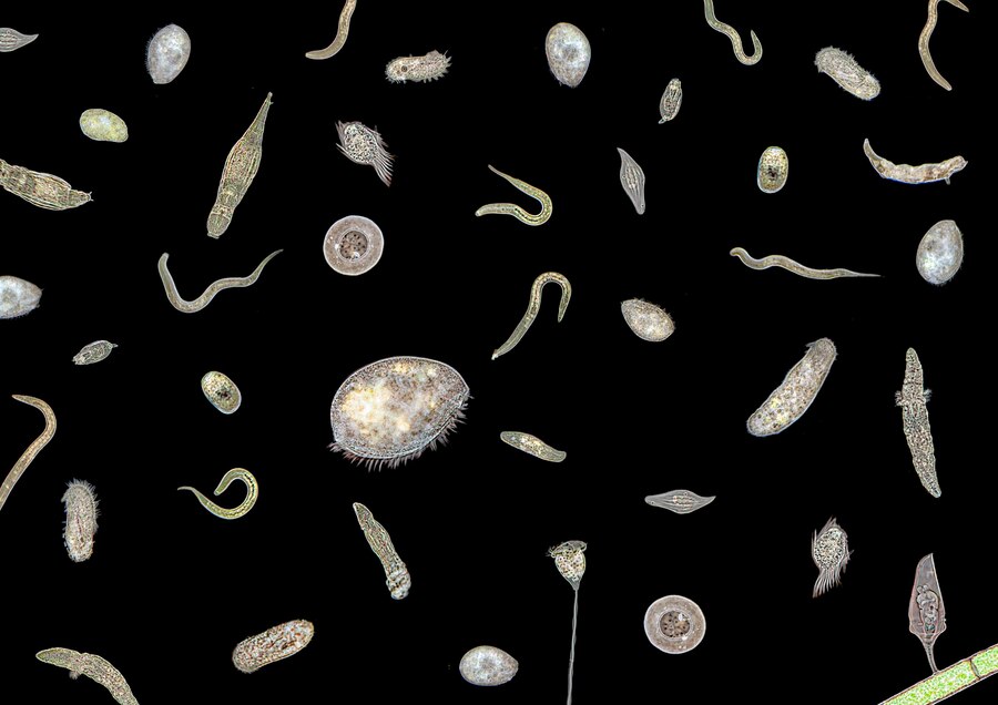 Pinworms: A Common Parasitic Infection