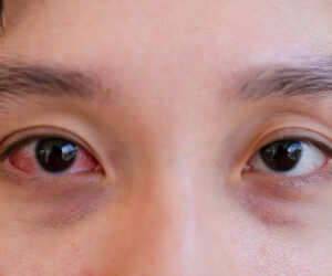 Top 5 Reasons to Seek Emergency Eye Care in Brampton Immediately